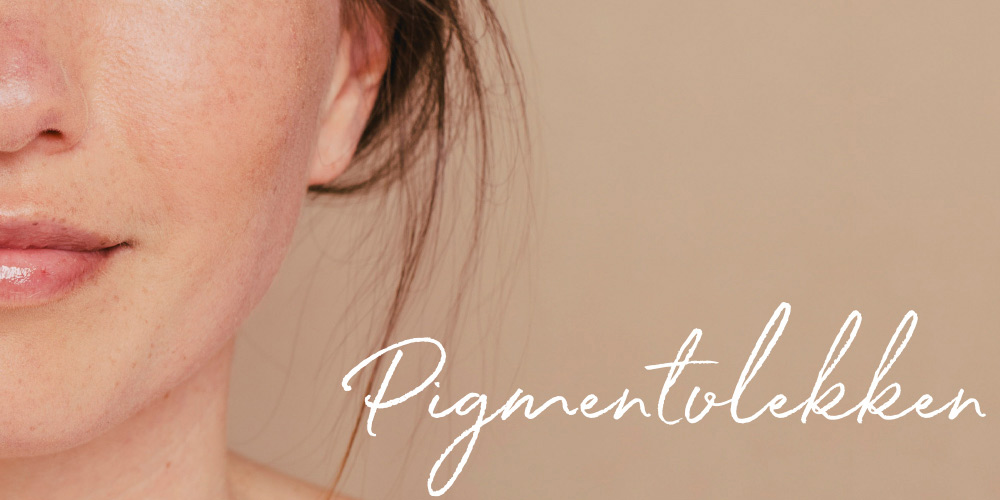 Hoe behandel je pigmentvlekken?