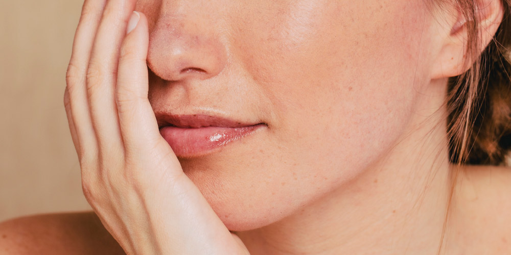 Heb ik mondhoekeczeem?