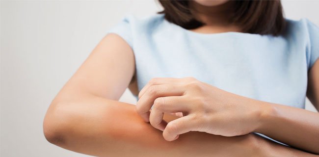 Zonneblaasjes, warmte-uitslag, jeukende bultjes ... Heb je een zonneallergie?