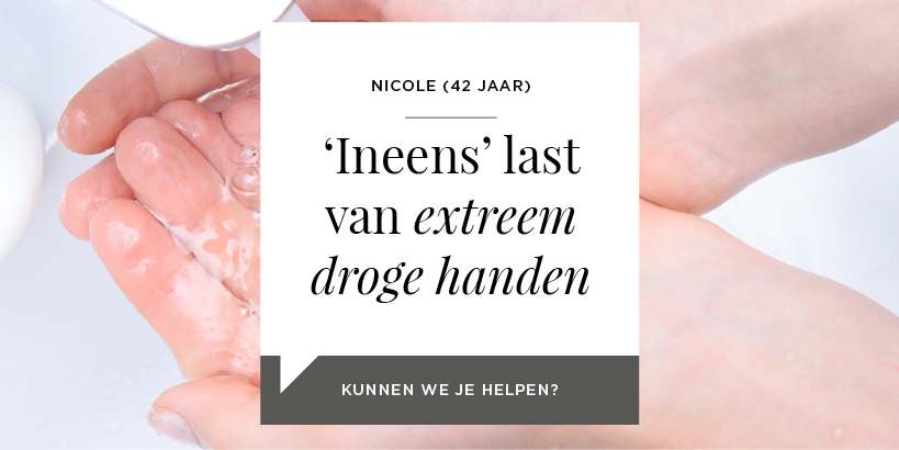 Ineens last van extreem droge handen