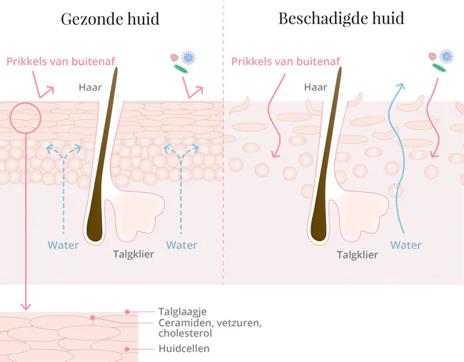 Gezonde versus beschadigde huidbarrière – Dr. Jetske Ultee