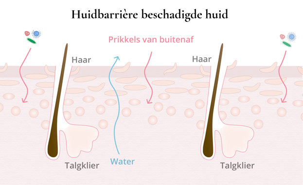 Huidbarrière beschadigde huid