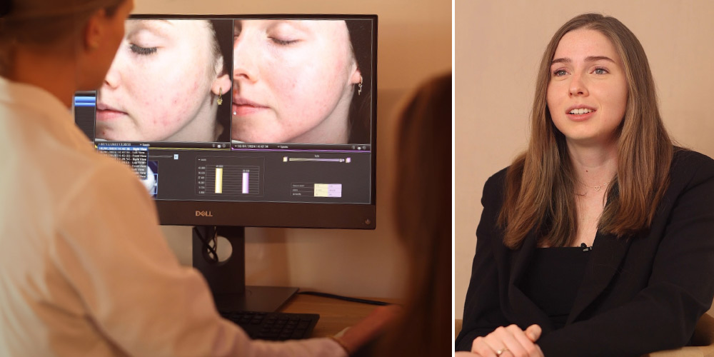 Fleur testte de Extra Strong Exfoliant van <br>Dr. Jetske Ultee, en dit is haar ervaring: <br>“Deze blijft zeker in mijn routine”